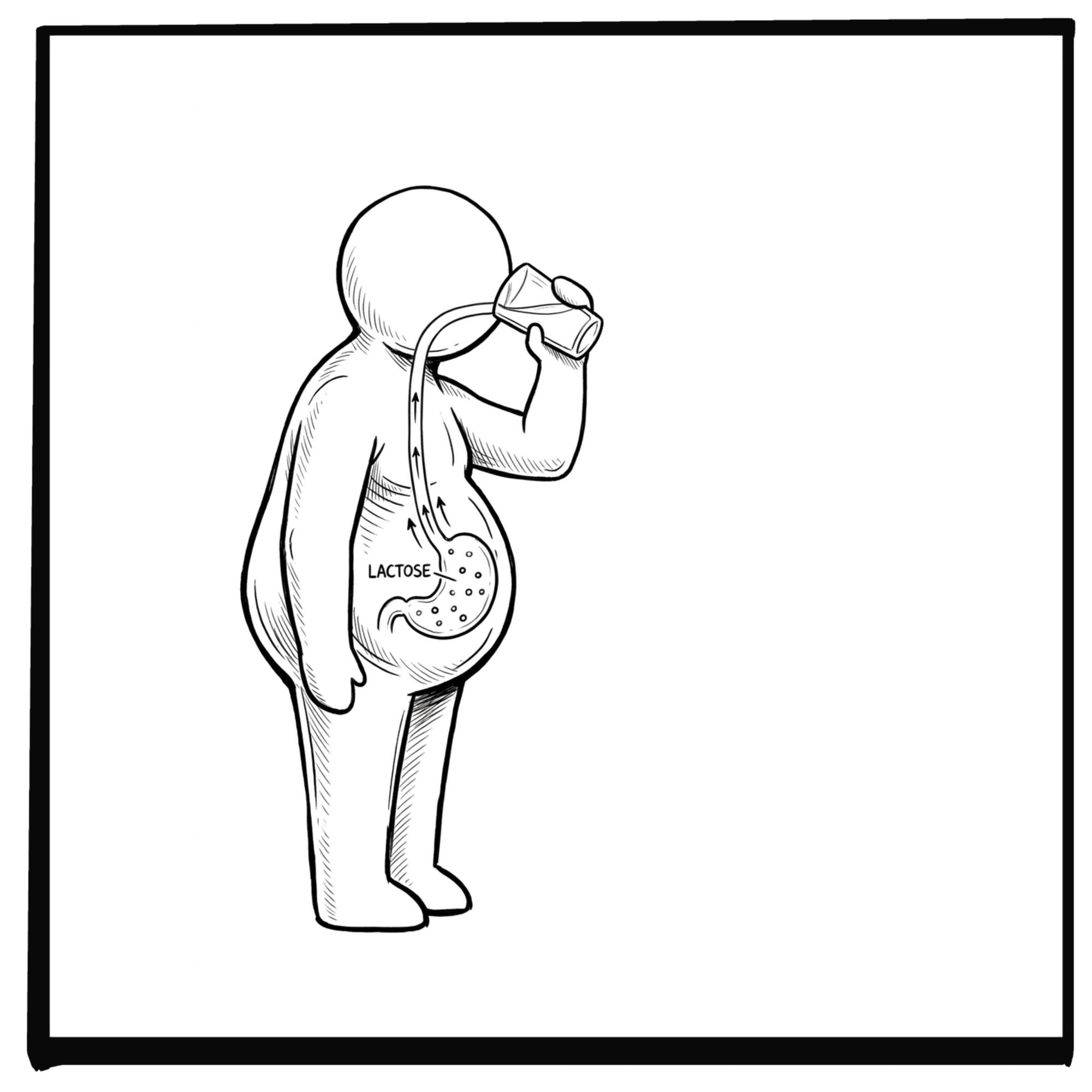 Does Milk Help Acid Reflux?