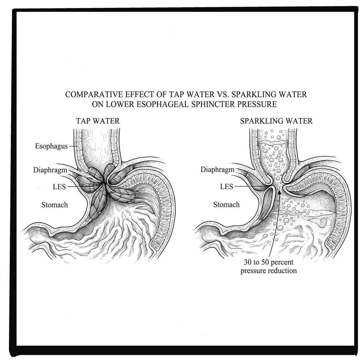 Does Water Help Acid Reflux? Yes, But Not How You Think