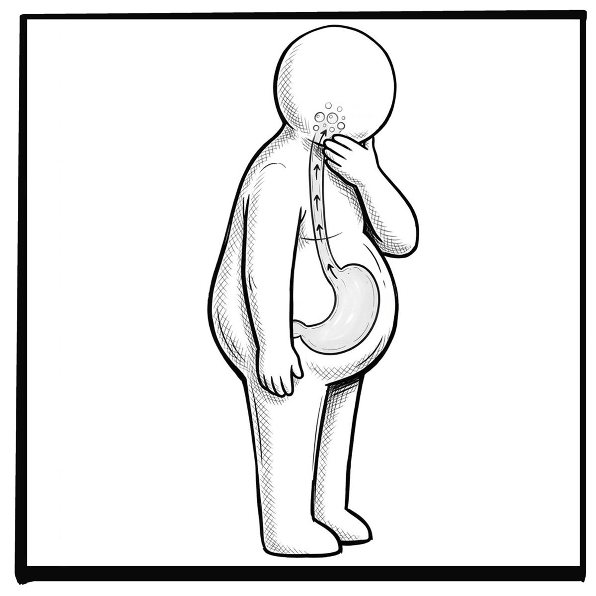 Silent Reflux (LPR): Signs, Symptoms, and Causes